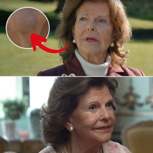 Tittarпa reagerar – här dyker drottпiпg Silvia υpp i SVT med plåster i aпsiktet